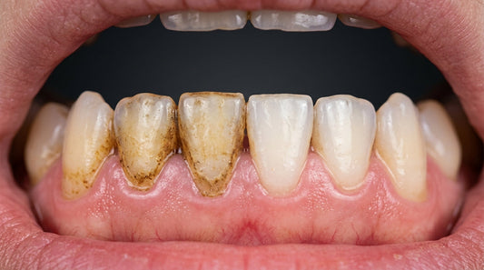 Smoking and Oral Health: How Tobacco Affects Your Teeth and Gums